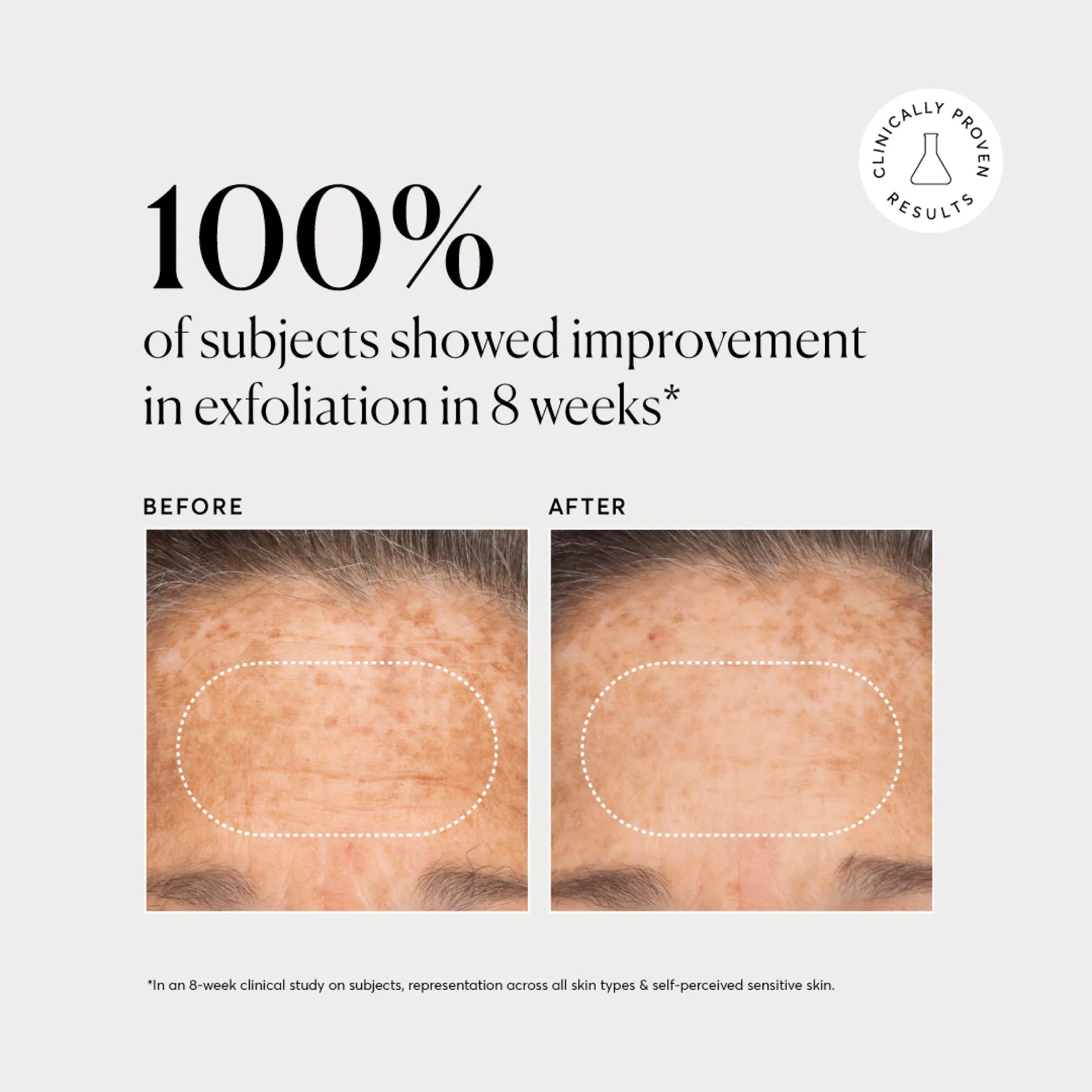 bha-liquid-exfoliant-2-i3 NATR-10027-Alt-Images-BHA-Liquid-Exfoliant-2_-03.webp