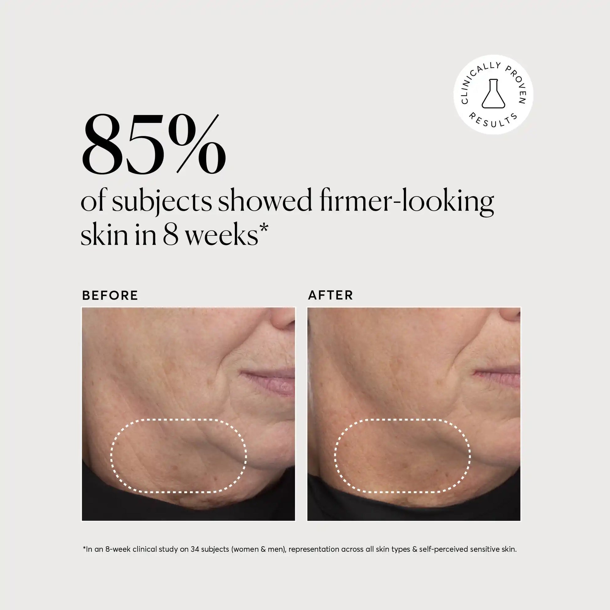 retinol-complex-serum-u1 NATR-10034-Alt-Images-Retinol-Complex-Serum-04.webp